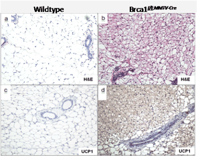 Supraclavicular Fat Pads