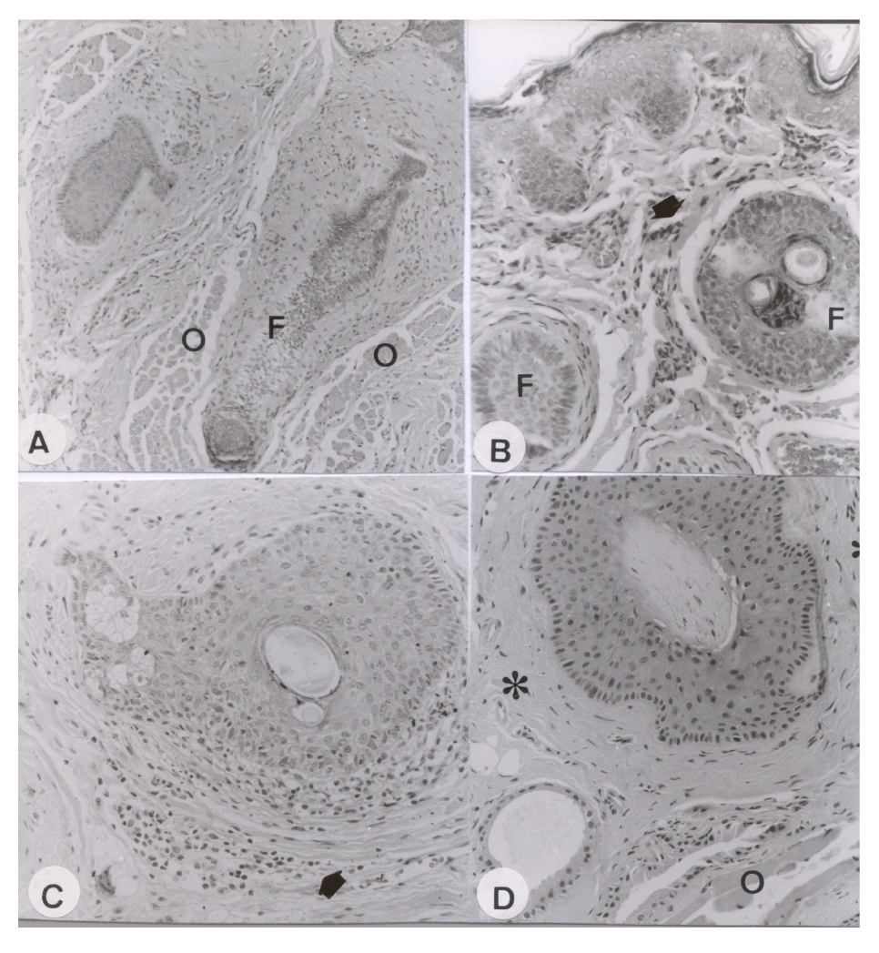 Muscle Of Riolan