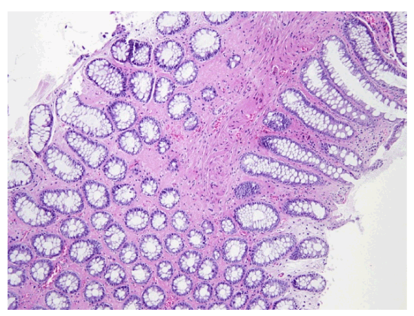 normal colon histology