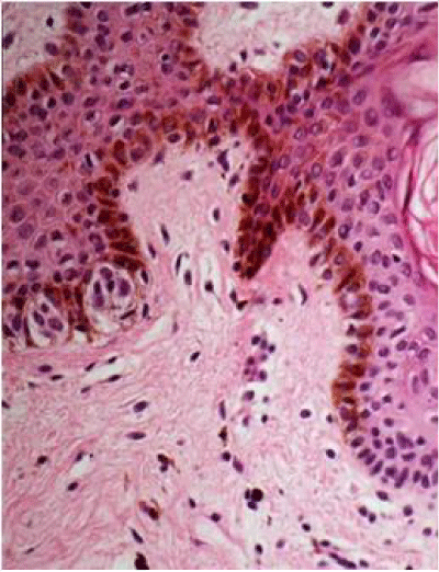 Hematoxylin