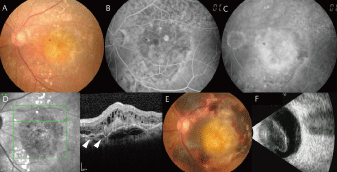 Fundus