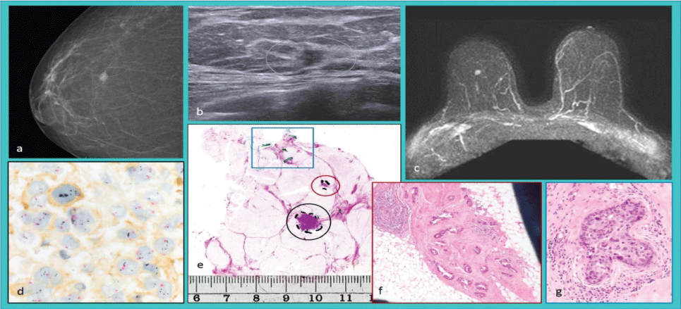 Radiologicallyunifocal