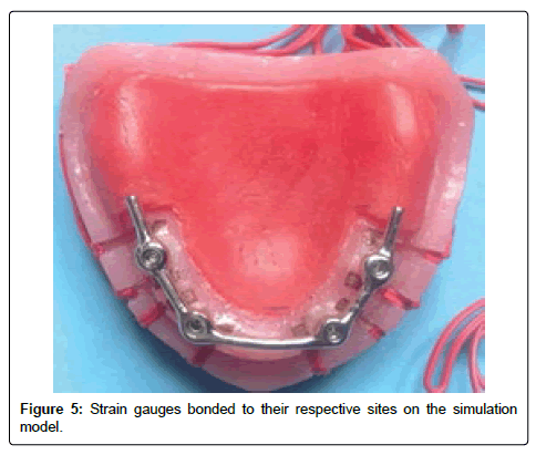 oral-hygiene-and-health-bonded