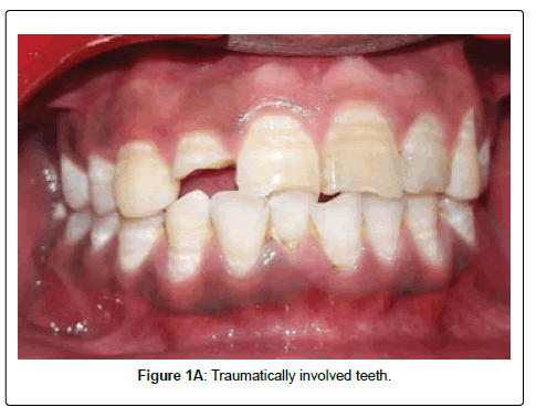 oral-hygiene-and-health-involved