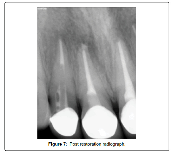 oral-hygiene-and-health-radiograph