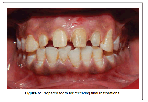 oral-hygiene-and-health-receiving