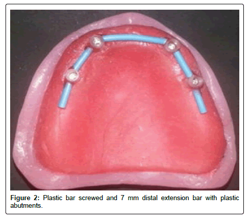 oral-hygiene-and-health-screwed
