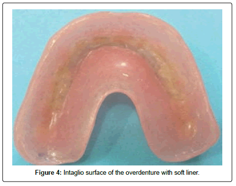 oral-hygiene-and-health-surface