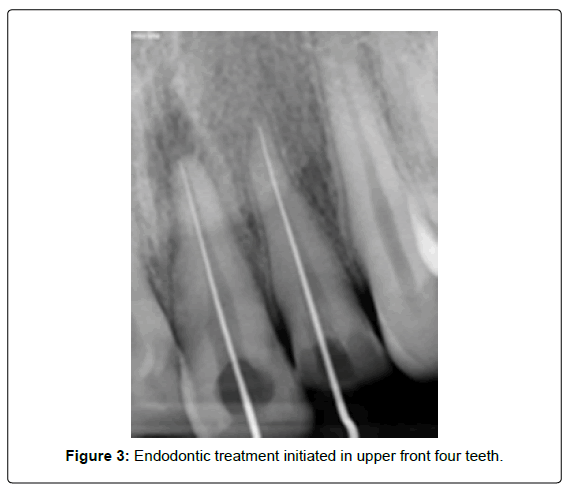 oral-hygiene-and-health-upper