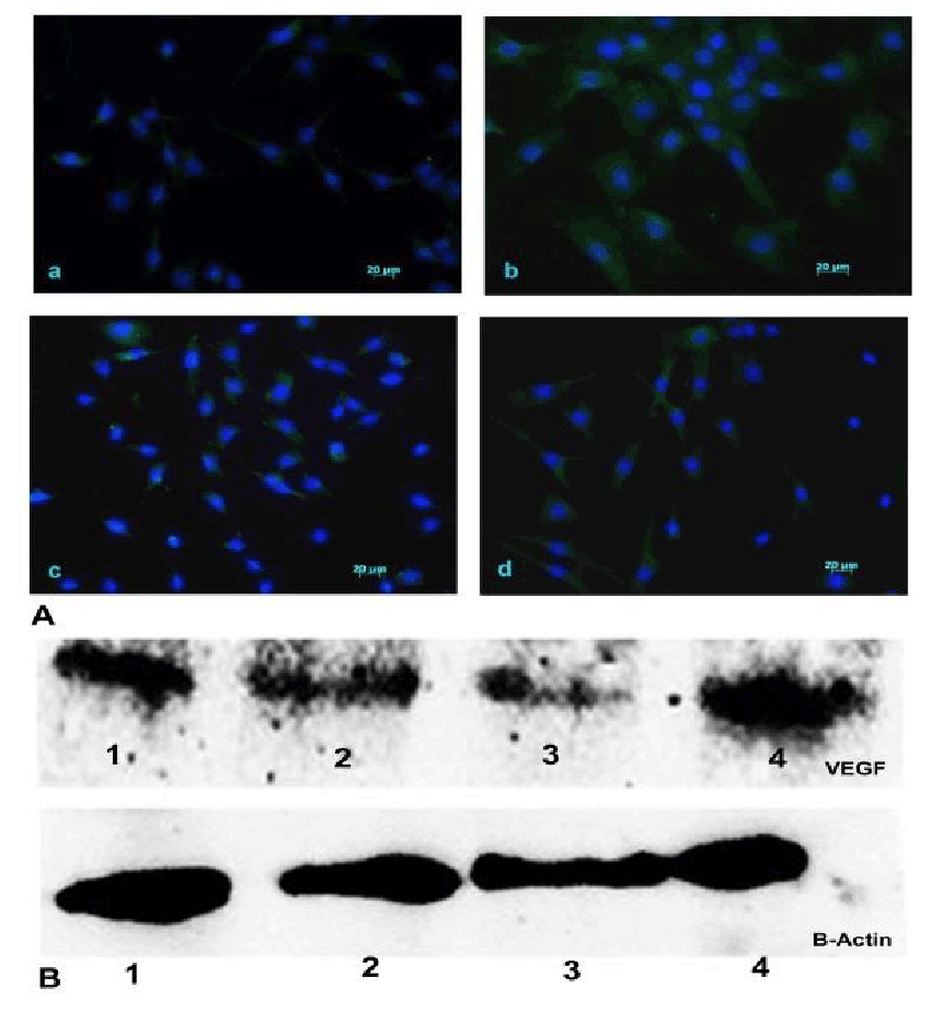 factor protein