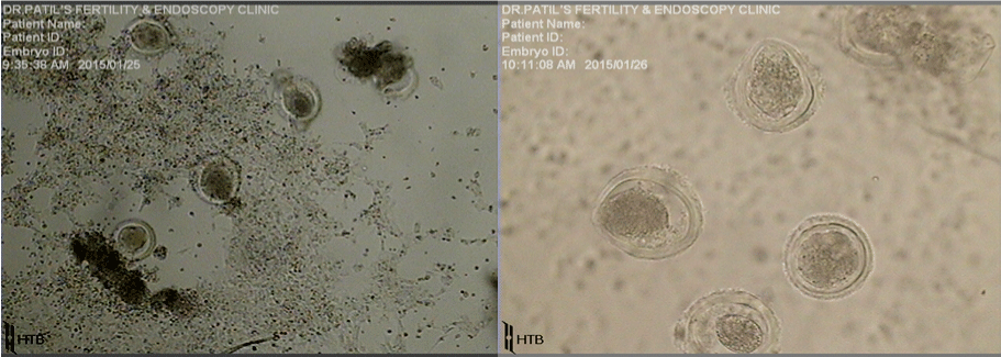 oocytes