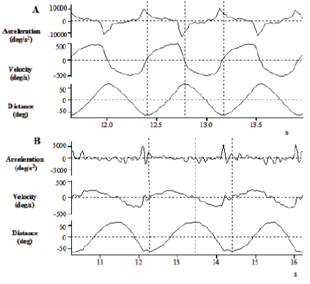 Kinematic