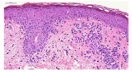 Histolopathologic