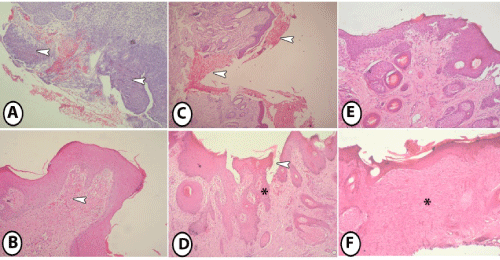 Histopathological