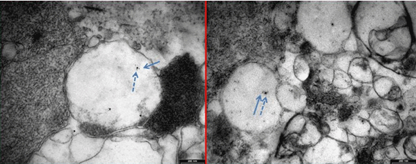 Immunoeletron