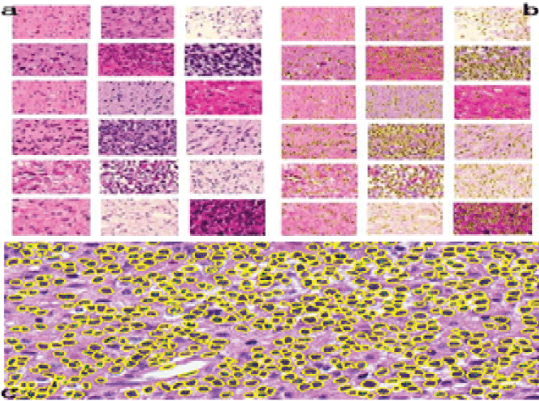 segmentation