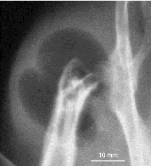 subcutaneous