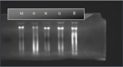 electrophoresis