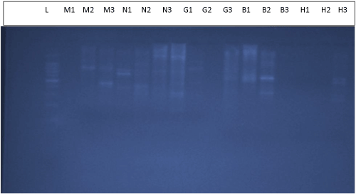 electrophoresis