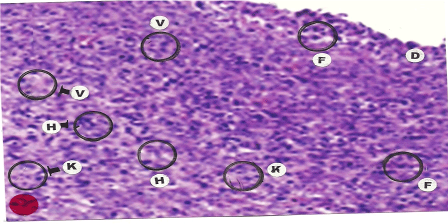 epidermis