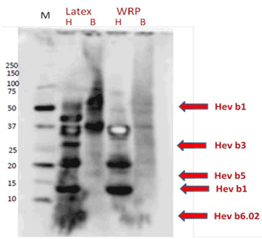 Immunoblot of protein