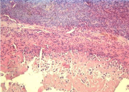 hematoxylin