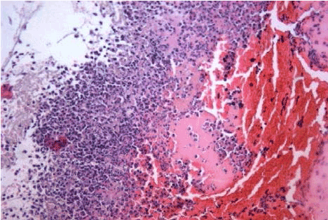 hematoxylin