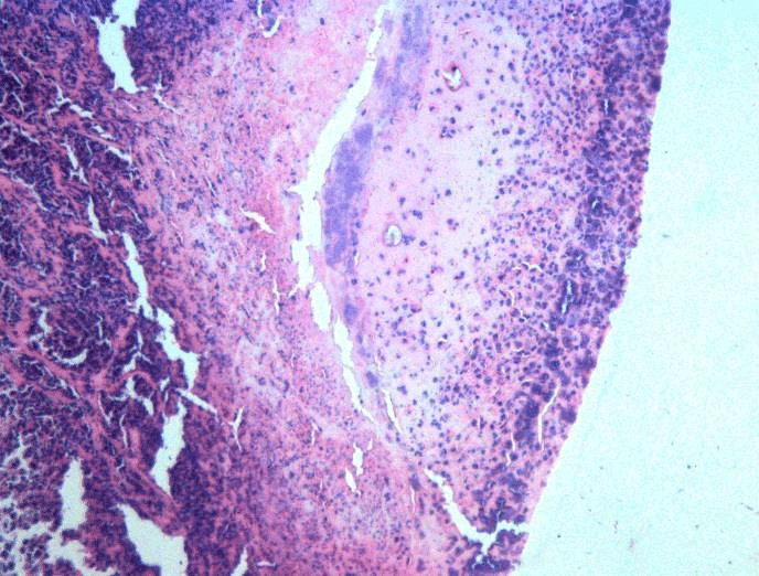 hematoxylin-eosin stain