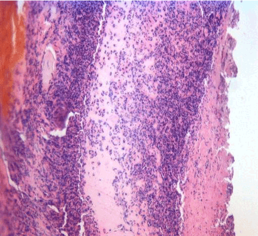 hematoxylin-eosin stain,