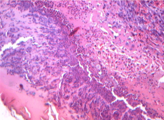 hematoxylin-eosin stain,