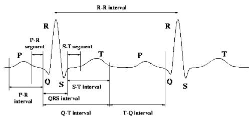 waveform