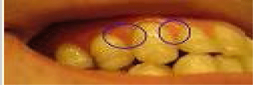 Papilla