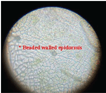 Epidermis