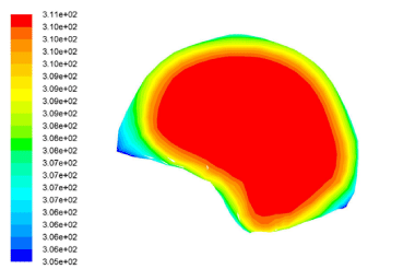 distribution