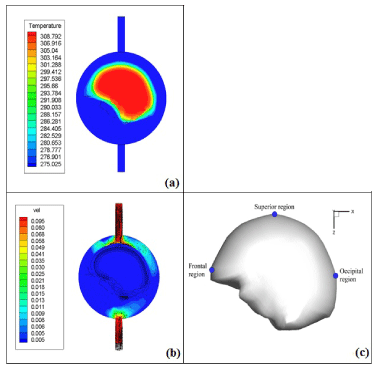 distribution