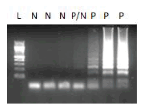 Electrophoresis