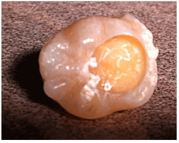 molar