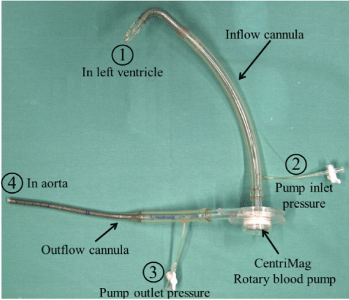 cannula