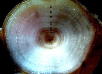 vertebral