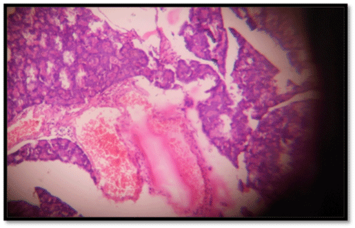 epithelial