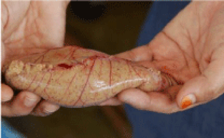 Ovary