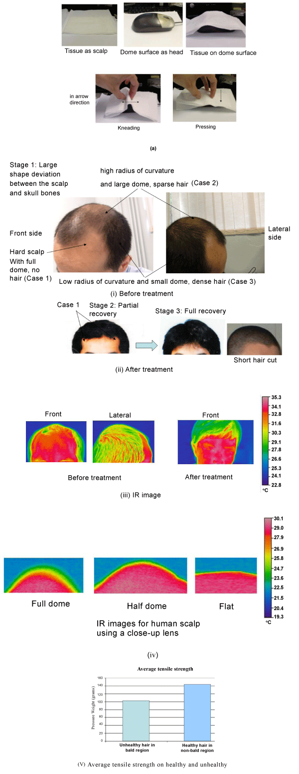 Figure 4 Figure 4