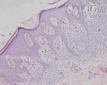 Photomicrograph