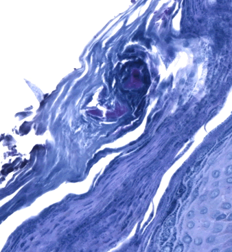 Axillary
