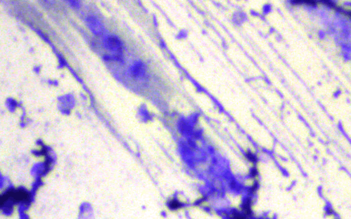 Biofilm