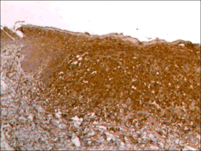 Immunohistochemical