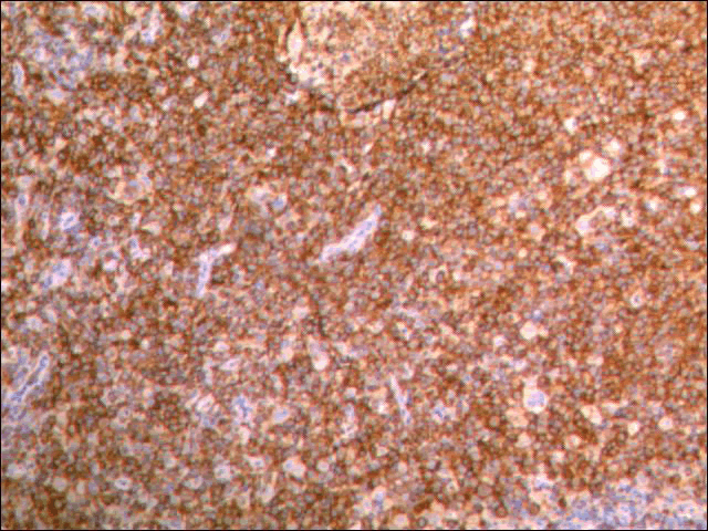 Immunohistochemical
