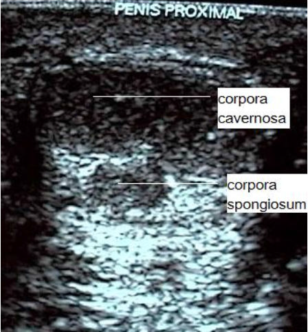 vesicular