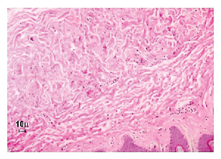 haematoxylin