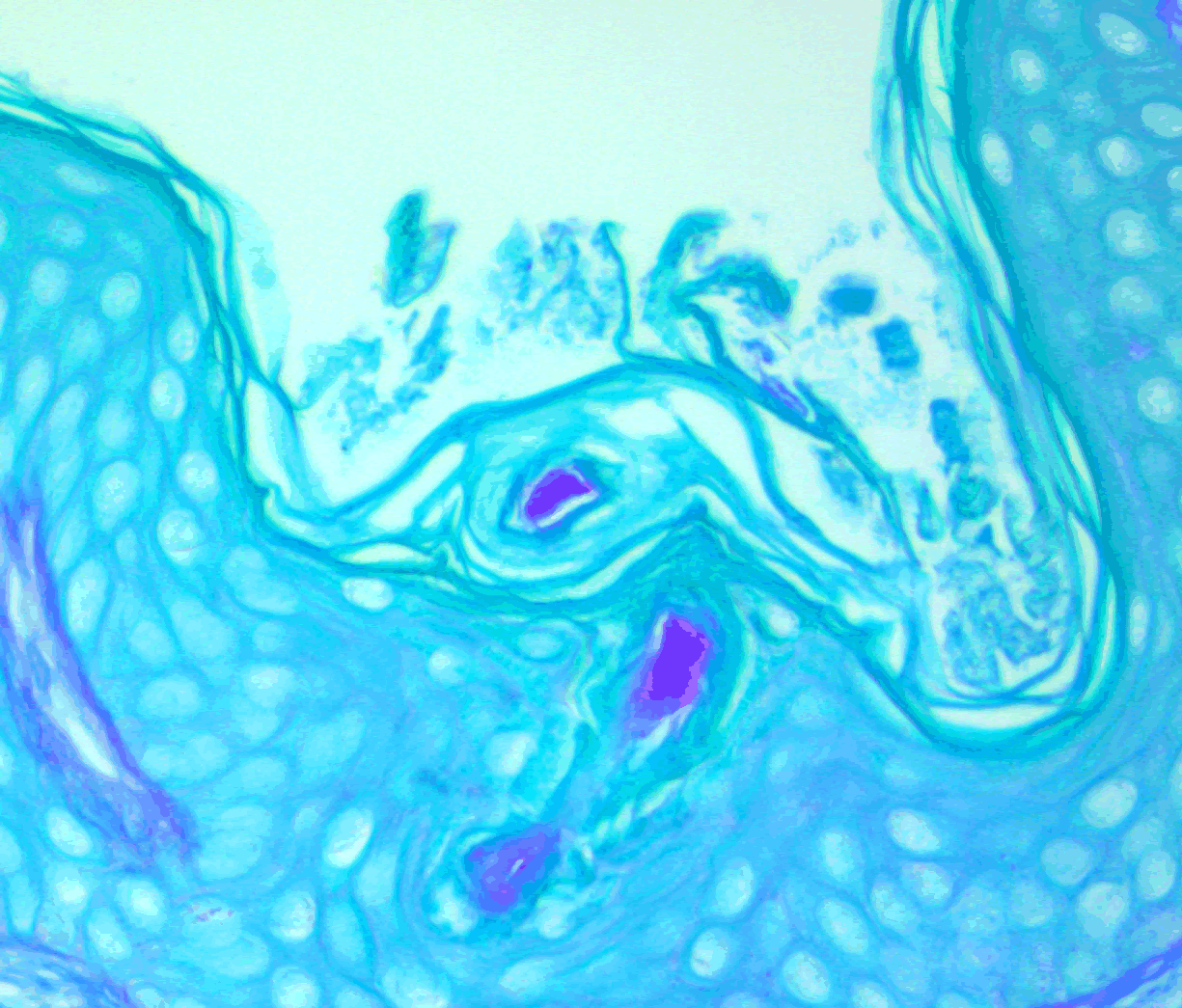 Pathology